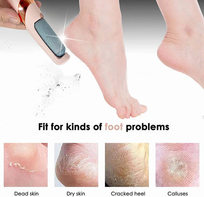 Electric Foot File & Callus Remover